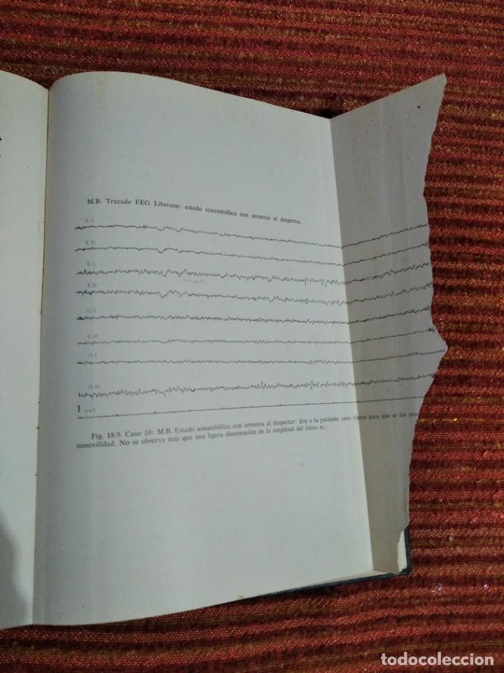 Libros de segunda mano: Libro Tratado de Hipnosis Sofrologia de Franco Granone 1973 - Foto 26