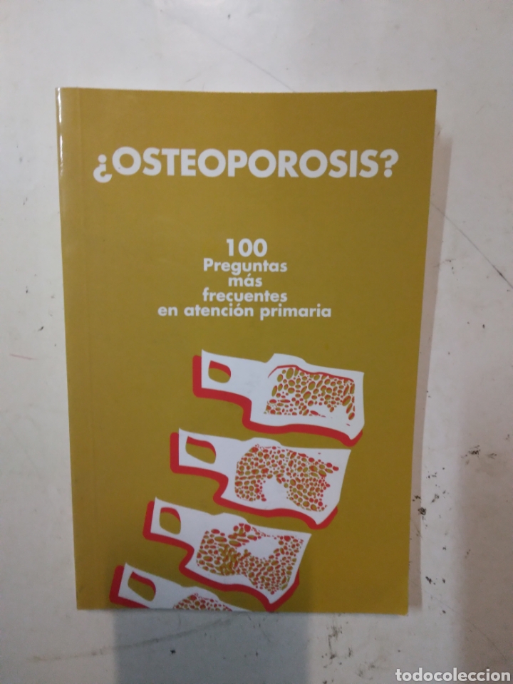 Libros de segunda mano: Osteoporosis - Foto 1