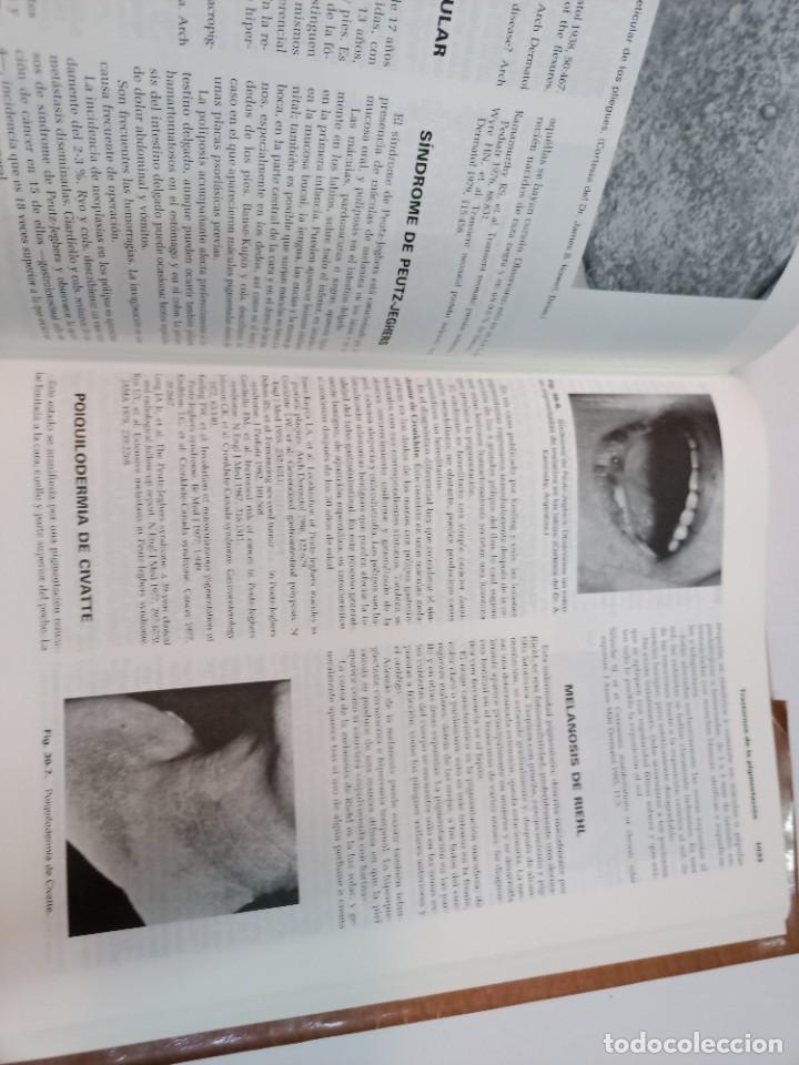 Libros de segunda mano: VV.AA Tratado de dermatologia SA7062 - Foto 3
