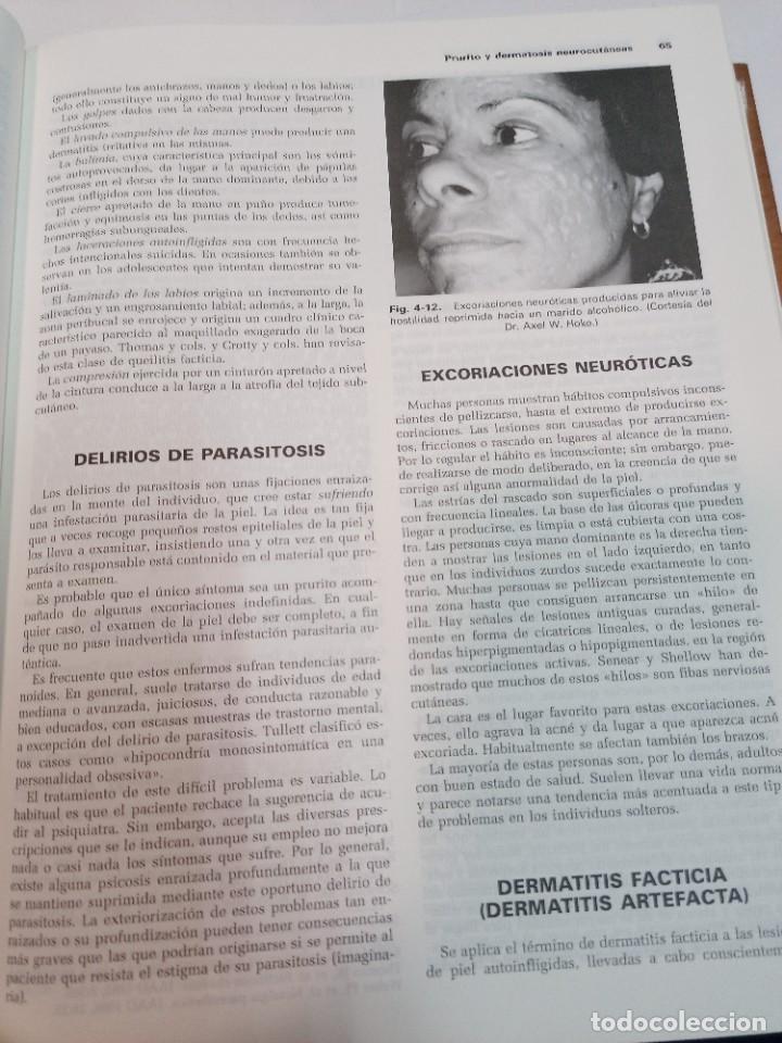 Libros de segunda mano: VV.AA Tratado de dermatologia SA7062 - Foto 4