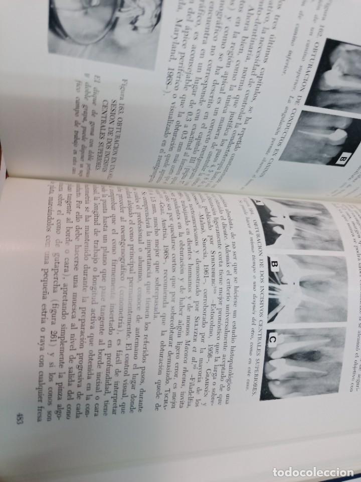 Libros de segunda mano: ANGEL LASALA Endodoncia SA7480 - Foto 4