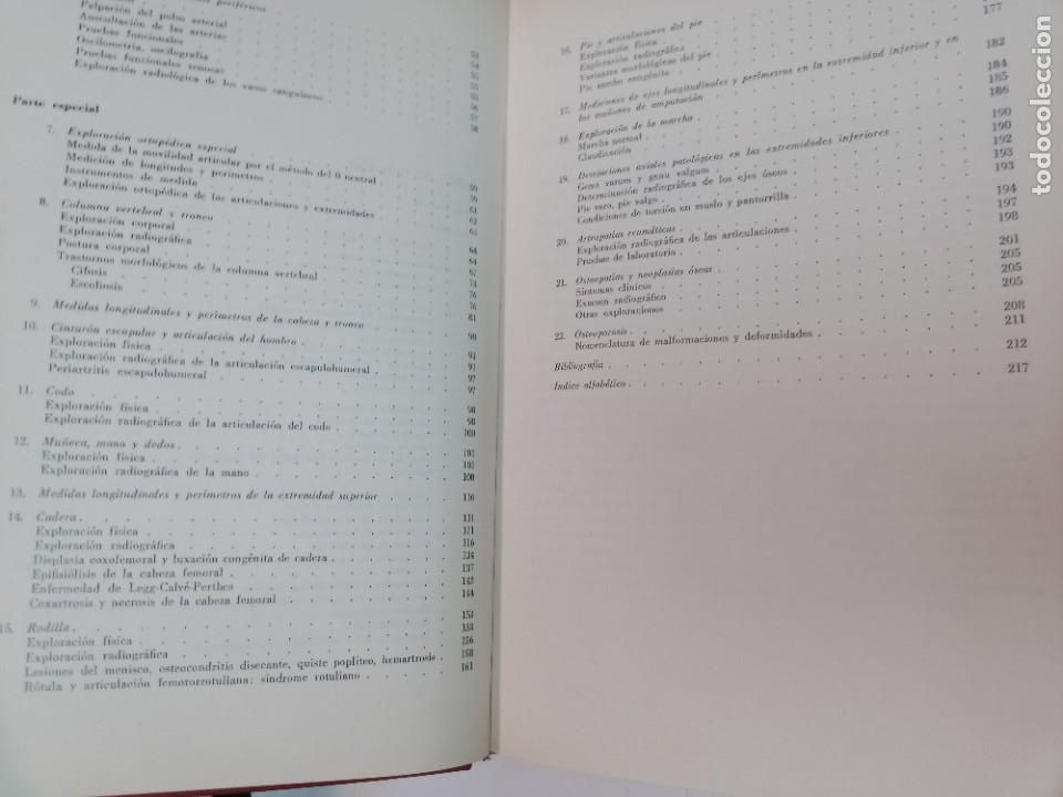 Libros de segunda mano: H. U. DEBRUNNER Diagn&oacute;stico ortop&eacute;dico SA9261 - Foto 3