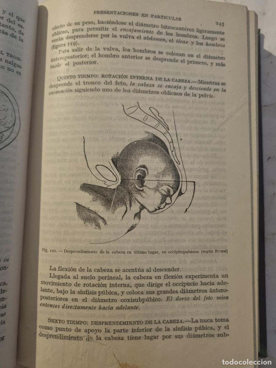 Libros de segunda mano: MANUAL DE OBSTETRICIA. L.DEVRAIGNE. ED: ESPASA-CALPE. MADRID,1943. - Foto 11
