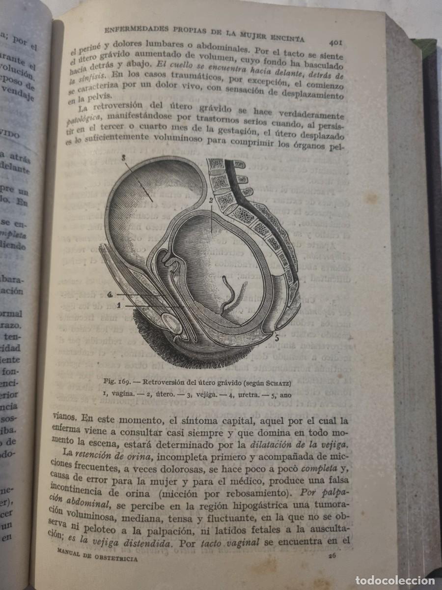 Libros de segunda mano: MANUAL DE OBSTETRICIA. L.DEVRAIGNE. ED: ESPASA-CALPE. MADRID,1943. - Foto 13