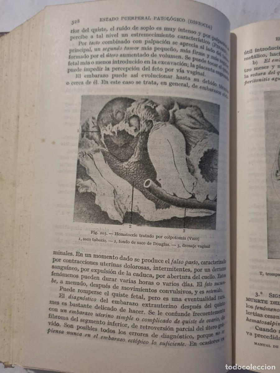 Libros de segunda mano: MANUAL DE OBSTETRICIA. L.DEVRAIGNE. ED: ESPASA-CALPE. MADRID,1943. - Foto 14