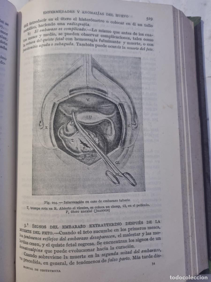 Libros de segunda mano: MANUAL DE OBSTETRICIA. L.DEVRAIGNE. ED: ESPASA-CALPE. MADRID,1943. - Foto 15