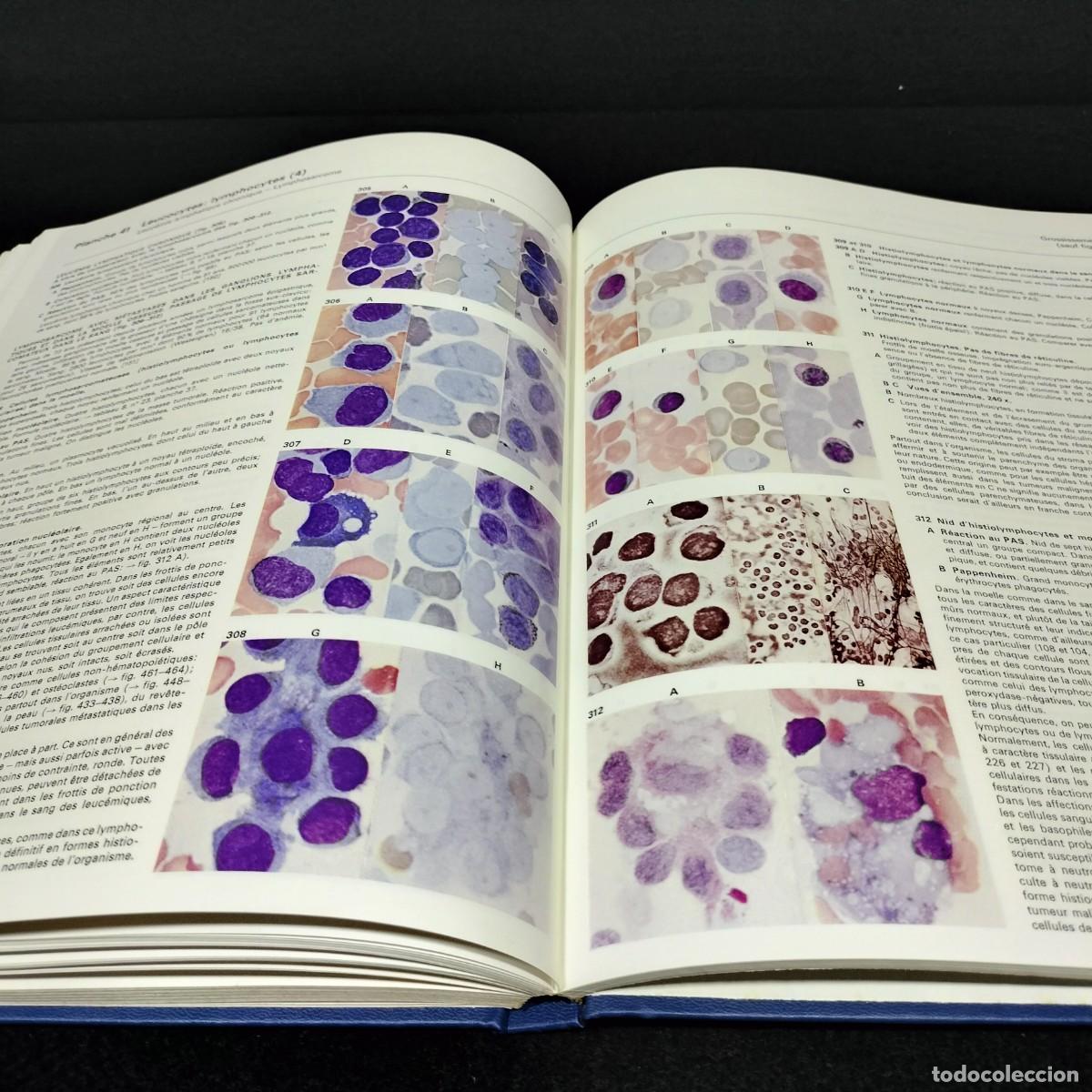 Libros de segunda mano: PLANCHES DH&Eacute;MATOLOGIE SANDOZ - SANDOZ / 25.718 - Foto 6