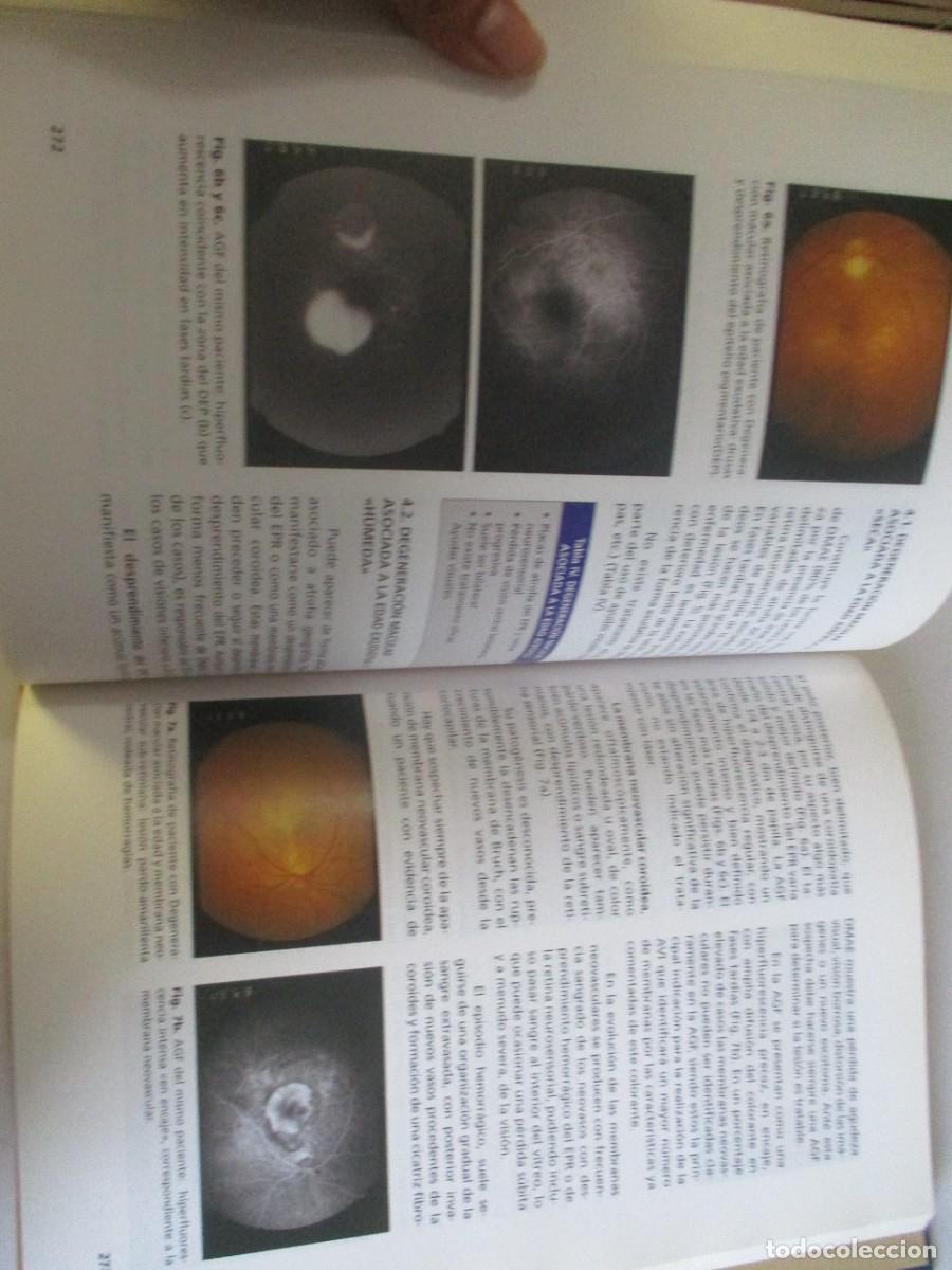 Libros de segunda mano: VV.AA. Oftalmolog&iacute;a general W22185 - Foto 4