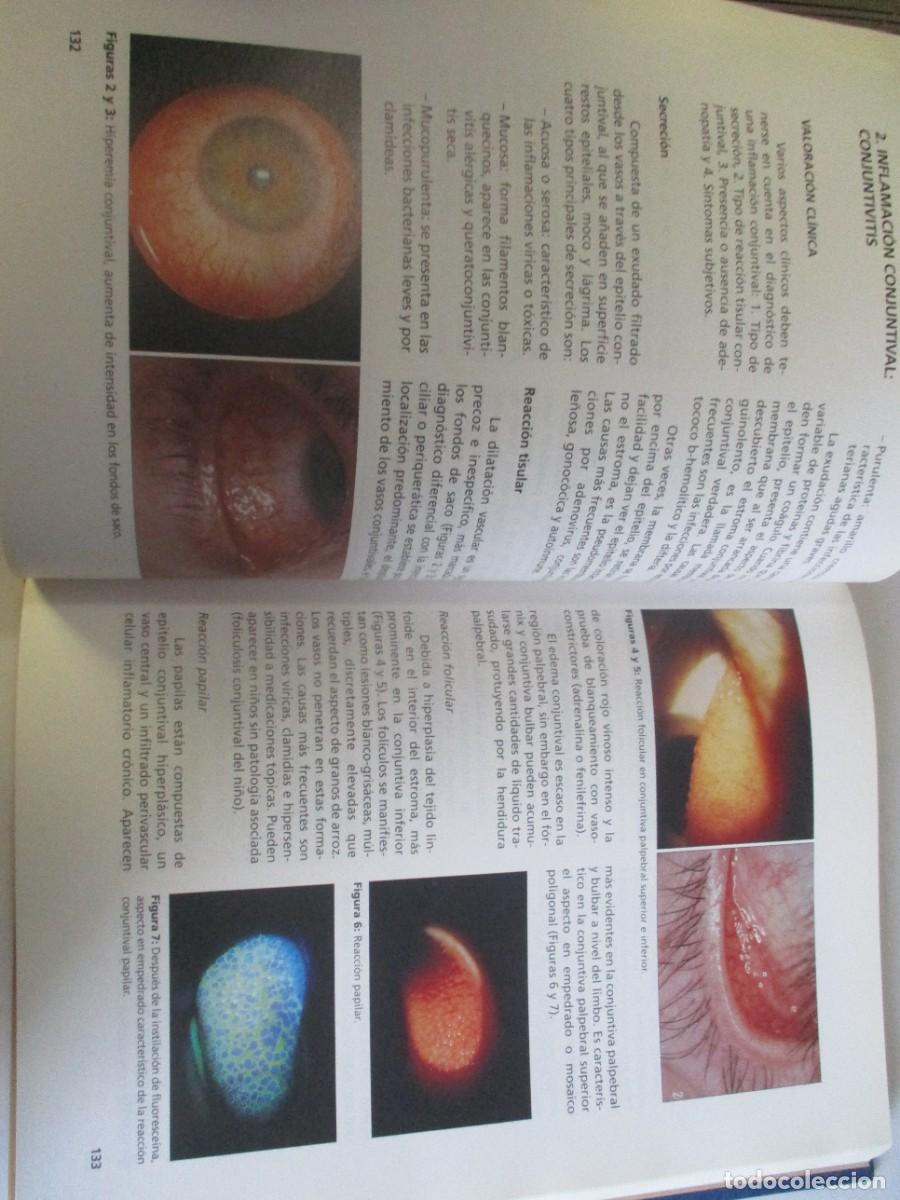 Libros de segunda mano: VV.AA. Oftalmolog&iacute;a general W22185 - Foto 5