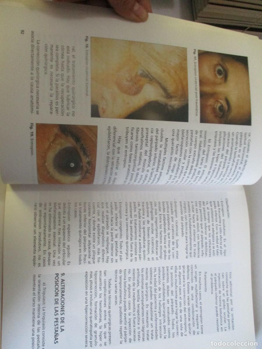 Libros de segunda mano: VV.AA. Oftalmolog&iacute;a general W22185 - Foto 6