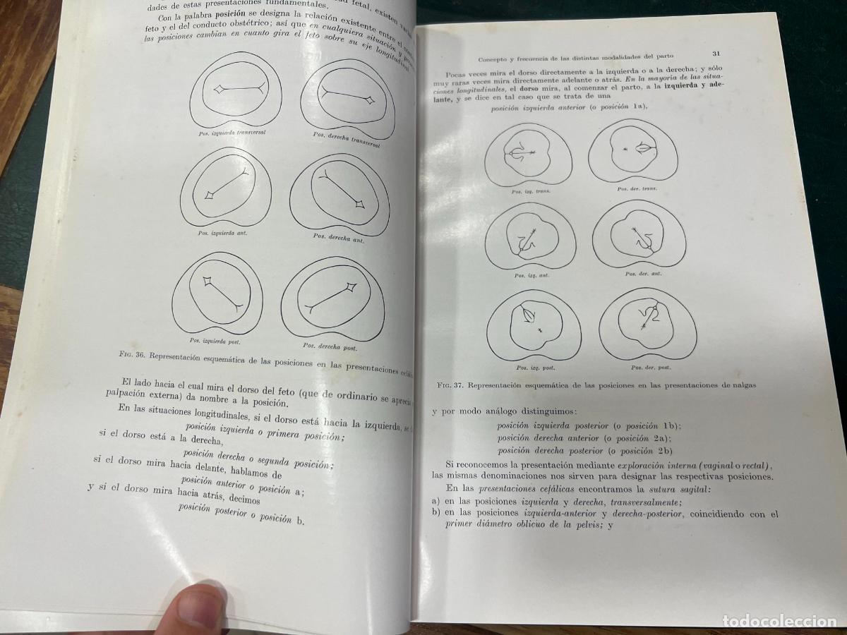 Libros de segunda mano: LIBRO OPERACIONES OBSTETRICAS - HEINRICH MARTIUS - A&Ntilde;O 1940 - Foto 5