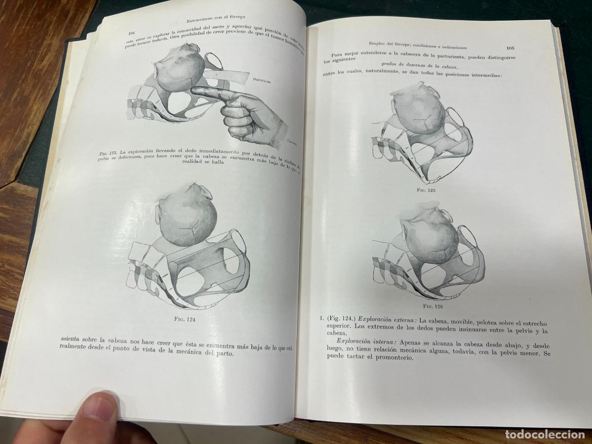 Libros de segunda mano: LIBRO OPERACIONES OBSTETRICAS - HEINRICH MARTIUS - A&Ntilde;O 1940 - Foto 6