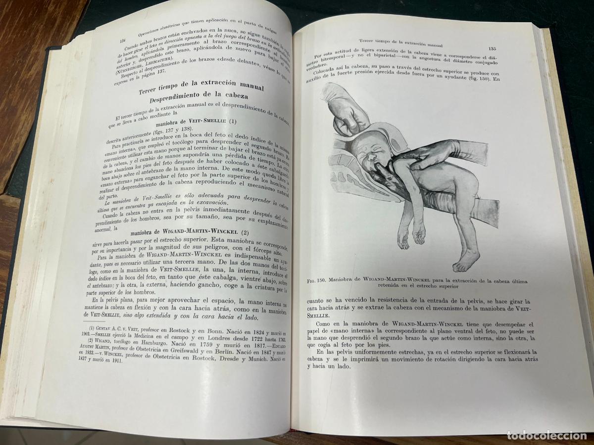 Libros de segunda mano: LIBRO OPERACIONES OBSTETRICAS - HEINRICH MARTIUS - A&Ntilde;O 1940 - Foto 7