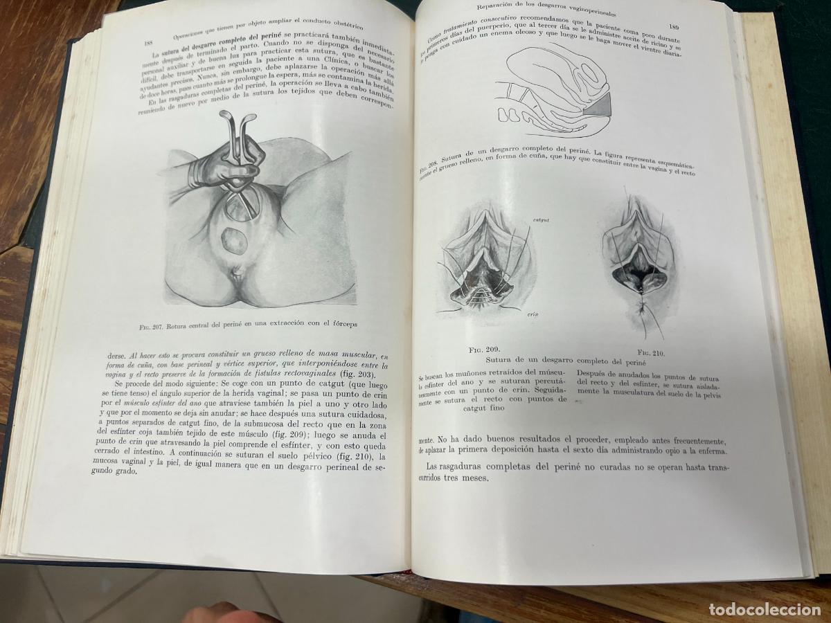 Libros de segunda mano: LIBRO OPERACIONES OBSTETRICAS - HEINRICH MARTIUS - A&Ntilde;O 1940 - Foto 8
