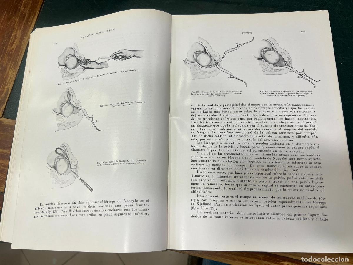 Libros de segunda mano: LIBRO TRATADO DE OBSTETRICIA OPERATORIA - A&Ntilde;O 1955 - Foto 8
