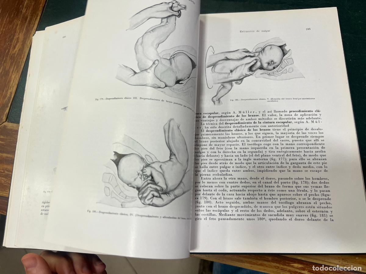 Libros de segunda mano: LIBRO TRATADO DE OBSTETRICIA OPERATORIA - A&Ntilde;O 1955 - Foto 9