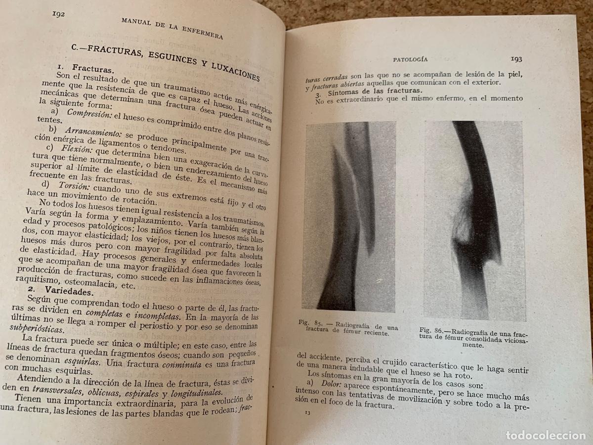Libros de segunda mano: Manual de la Enfermera (Bols 44) - Foto 2
