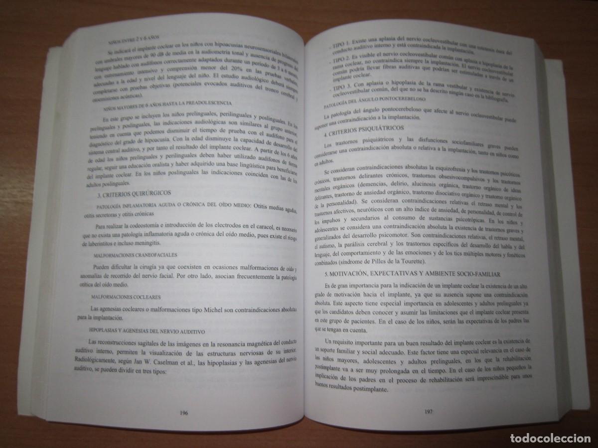 Libros de segunda mano: Manual de logopedia, Rosa Mar&iacute;a Pons Parra - Foto 3
