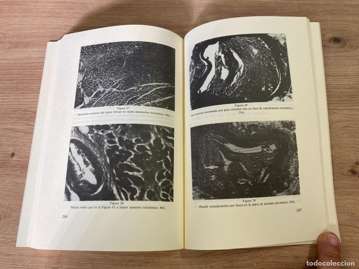 Libros de segunda mano: Muerte s&uacute;bita en la ciudad de Valencia - Foto 6