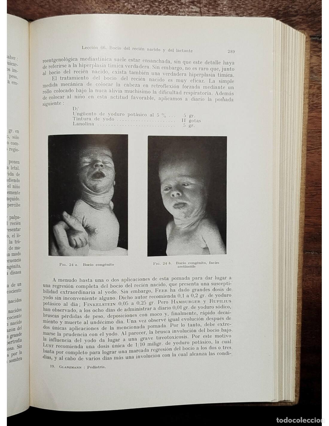 Libros de segunda mano: LECCIONES DE PEDIATR&Iacute;A. GLANZMANN, E.. Editorial Labor. 1942. - Foto 4