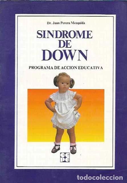 Libros de segunda mano: S&iacute;ndrome de Down - Juan Perera Mezquida