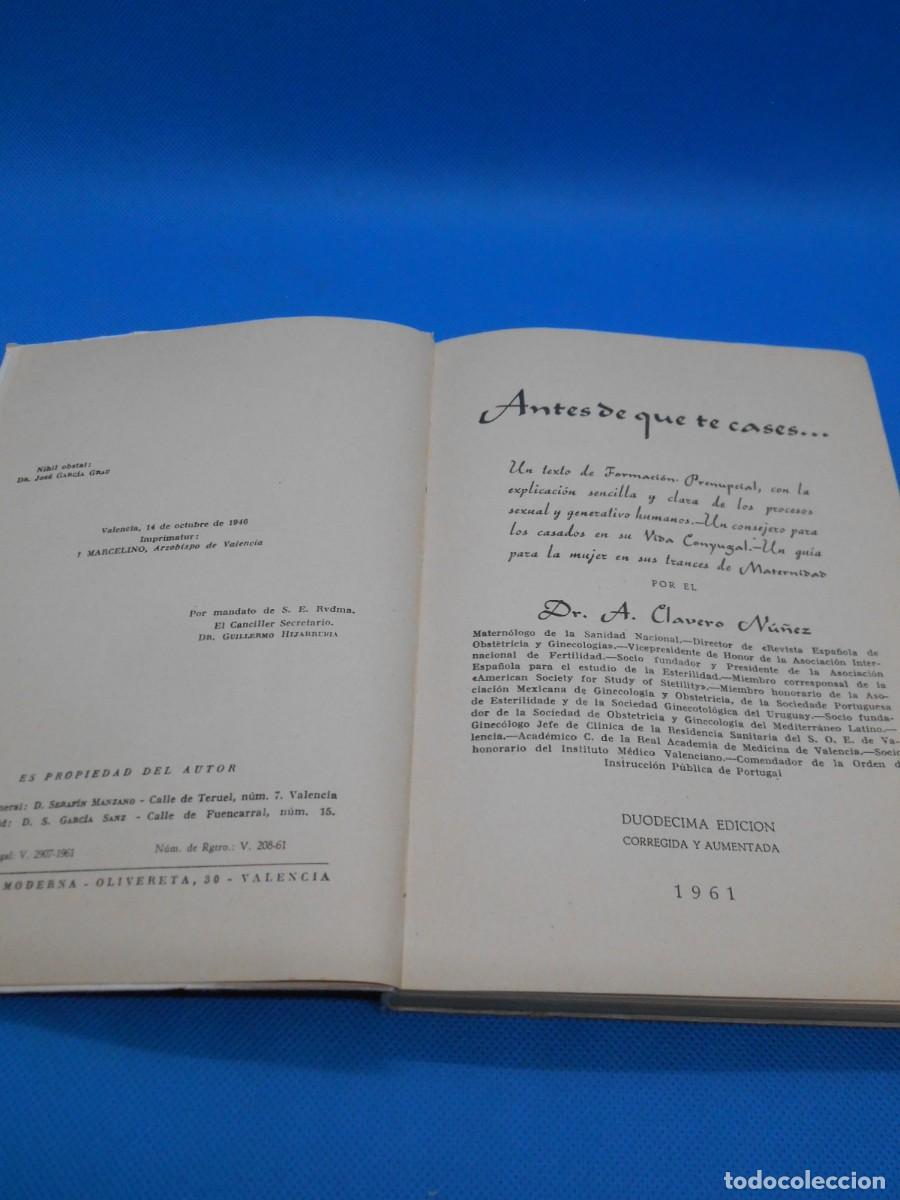 Libros de segunda mano: Antes de que te cases, 1961.Dr.Clavero N&uacute;&ntilde;ez - Foto 2