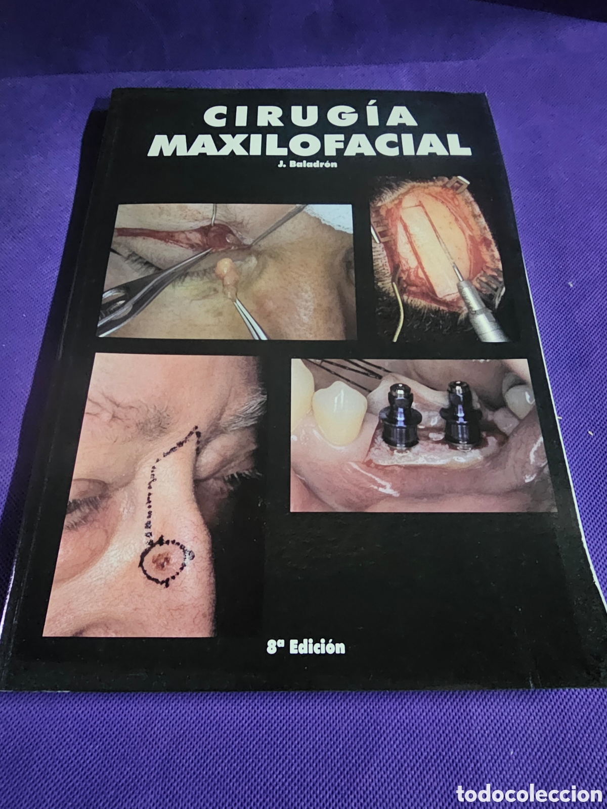 Libros de segunda mano: CIRUGIA MAXILOFACIAL.- J. BALADRON. - Foto 1