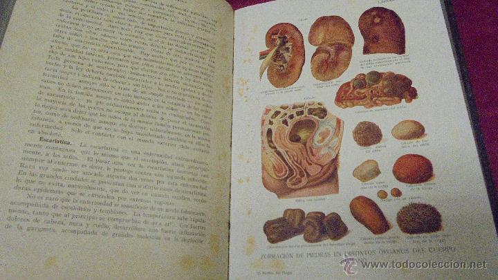 Libros: EL MEDICO DEL HOGAR. JENNY SPRINGER. ORBIS. 1931. CON SUPLEMENTOS. - Foto 7