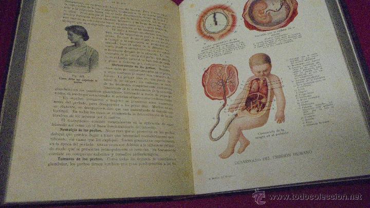 Libros: EL MEDICO DEL HOGAR. JENNY SPRINGER. ORBIS. 1931. CON SUPLEMENTOS. - Foto 9