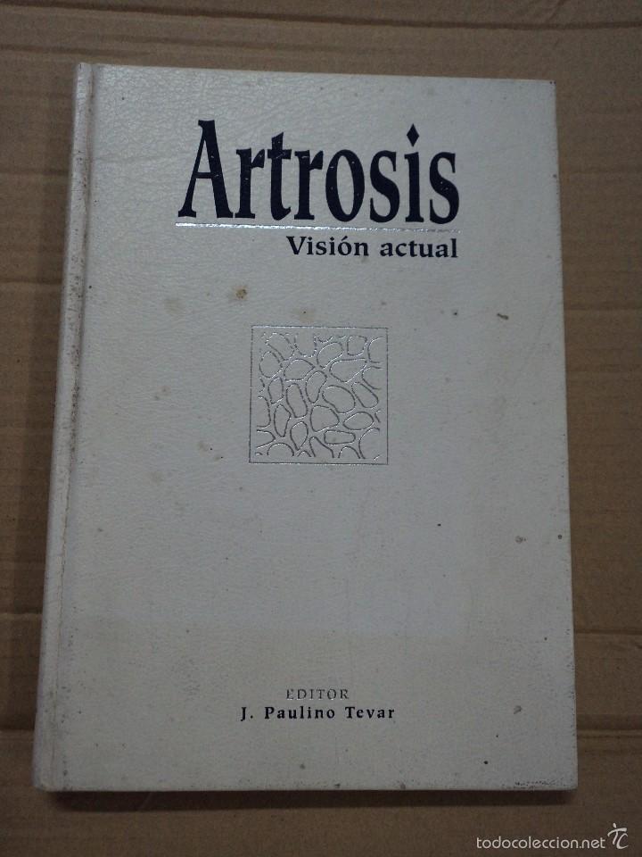 Libros: Artrosis - Visi&oacute;n actual - J. Paulino Tevar - Foto 1
