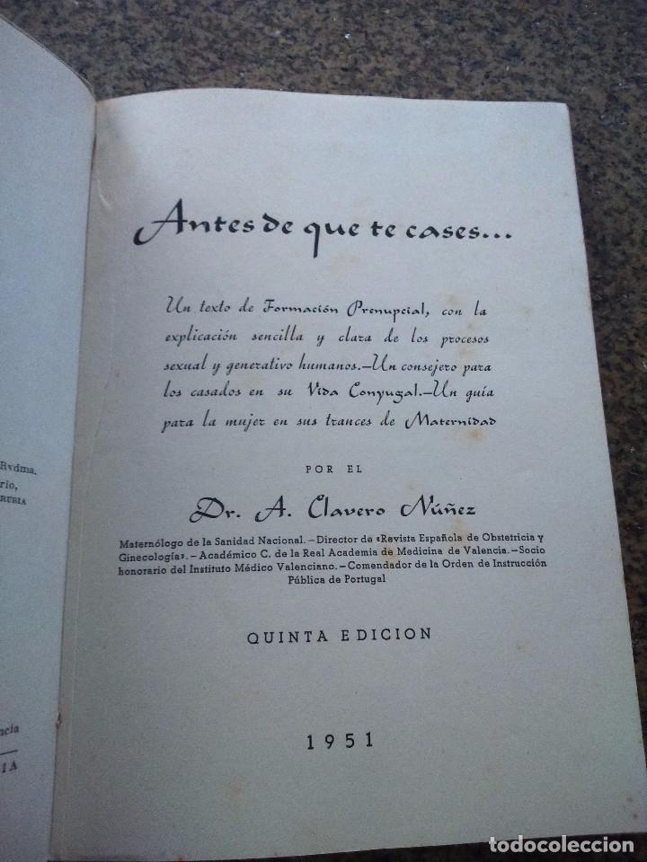 Libros: ANTES DE QUE TE CASES -- Dr. A. CLAVERO NU&Ntilde;EZ -- 1951 - - Foto 2