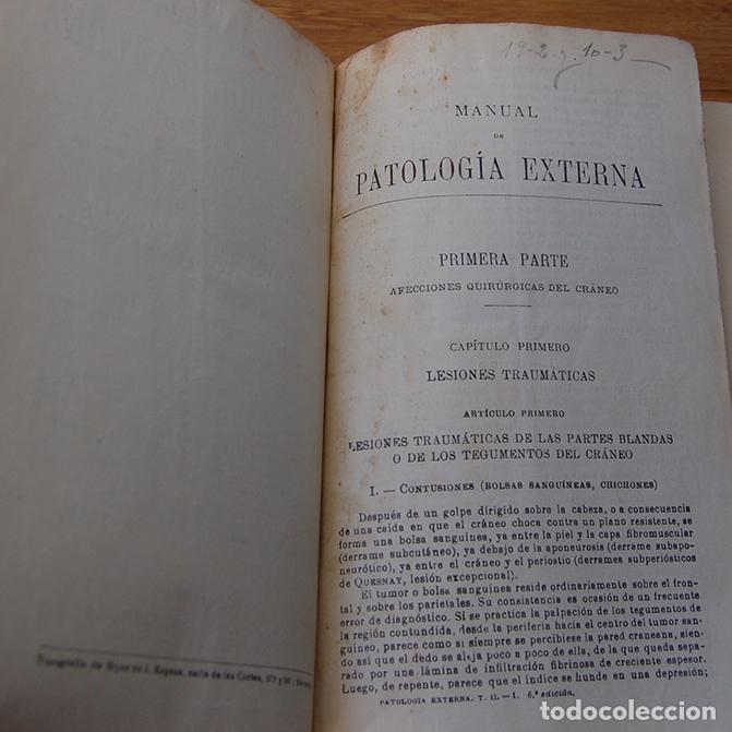 Libros: MANUAL DE PATOLOG&Iacute;A EXTERNA (2 Tomos) - E. FORGUE - Foto 3