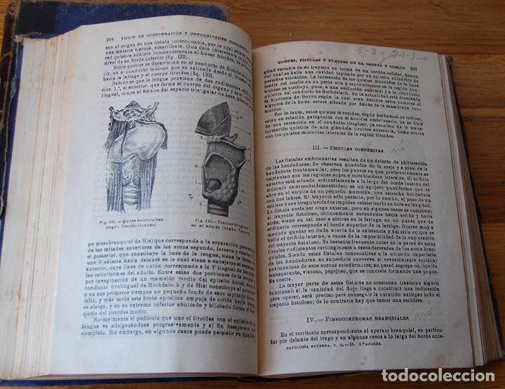 Libros: MANUAL DE PATOLOG&Iacute;A EXTERNA (2 Tomos) - E. FORGUE - Foto 5