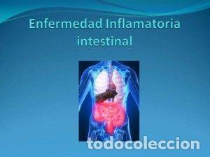 Libros: Enfermedad inflamatoria intestinal - Brooks Frank - Foto 1