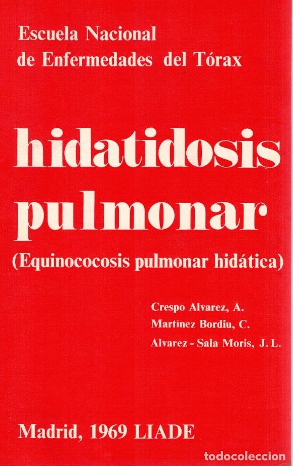 B&uuml;cher: HIDATIDOSIS PULMONAR (EQUINOCOCOSIS PULMONAR HID&Aacute;TICA ) - A. CRESPO &Aacute;LVAREZ / C. MARTINEZ BORDIU / J