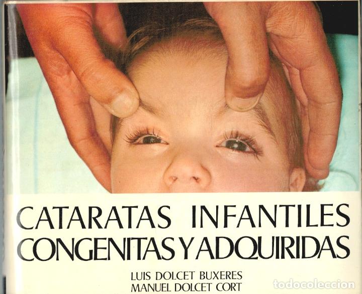 B&uuml;cher: CATARATAS INFANTILES CONG&Eacute;NITAS Y ADQUIRIDAS - Dolcet Buxeres, Luis / Dolcet Cort, Manuel