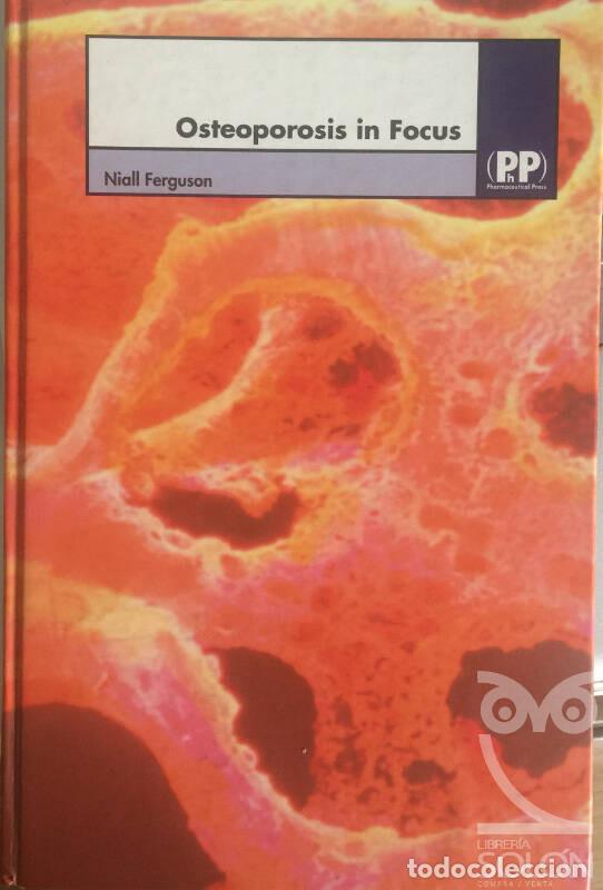 Libros: Osteoperosis in focus - Niall Ferguson - Foto 1