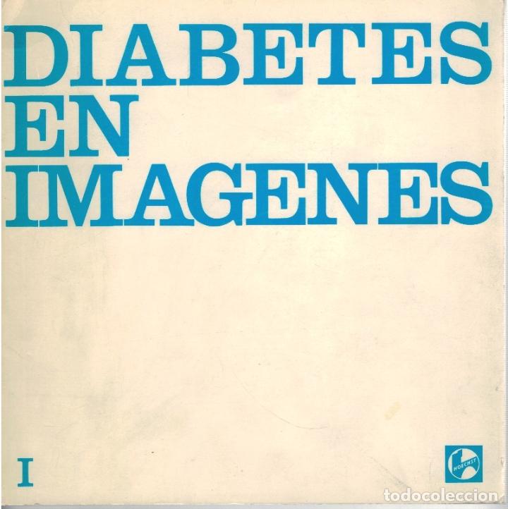 B&uuml;cher: DIABETES EN IM&Aacute;GENES (Ver Sumario en im&aacute;genes) - A. Bischoff