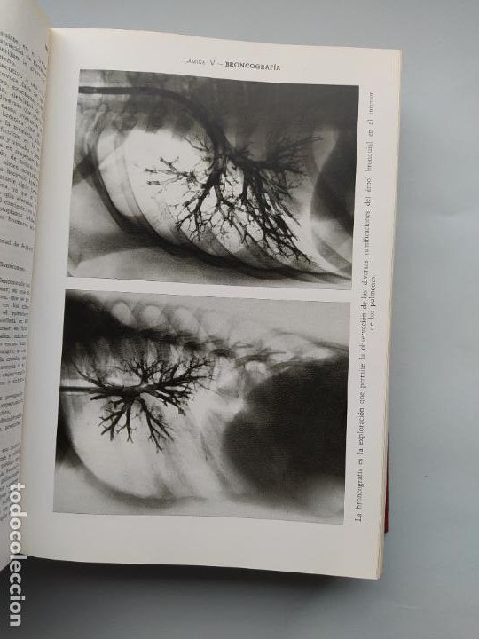 Libros: Diccionario M&eacute;dico Teide. 1971. CUARTA EDICION. TDK555 - - Foto 3