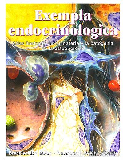 Libros: Exempla endocrinol&oacute;gica III - VVAA - Foto 1