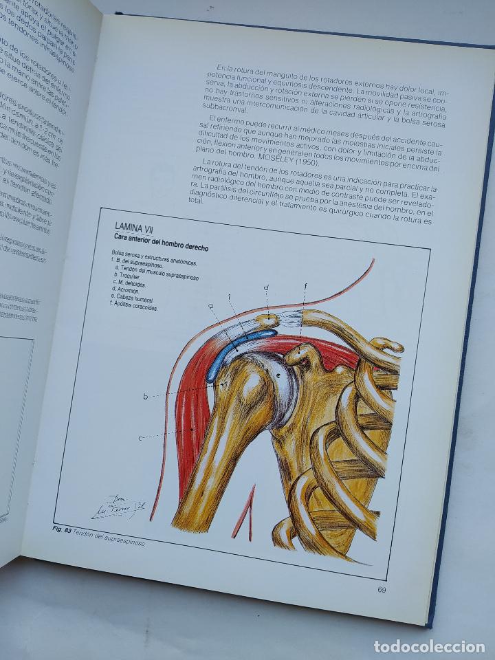 Libros: Periartritis. - DR. R. MOLERES FERRANDIS. TDK407 - Foto 2