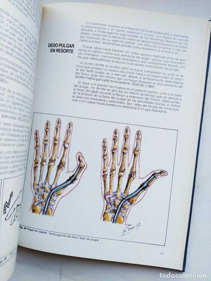 Libros: Periartritis. - DR. R. MOLERES FERRANDIS. TDK407 - Foto 3