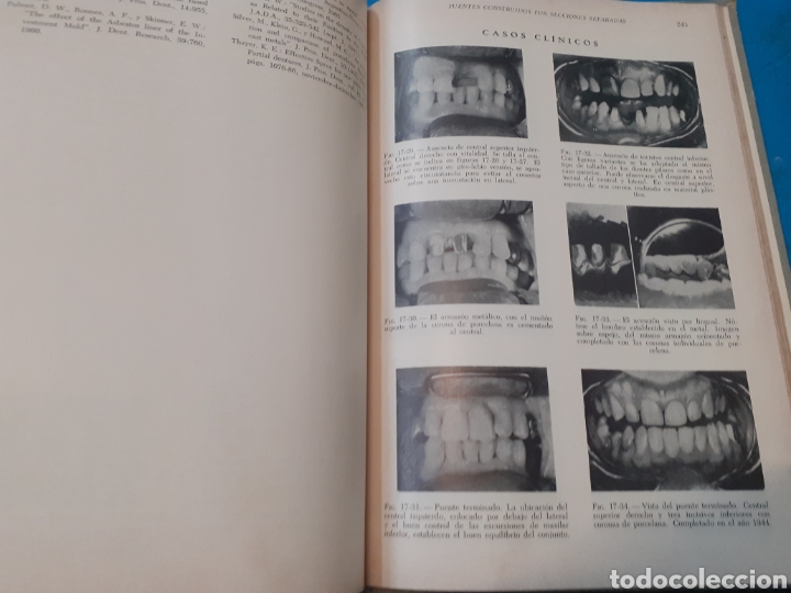 Libros: CERAMICA EN ODONTOLOGIA - KOHAN,Roberto. - Foto 5