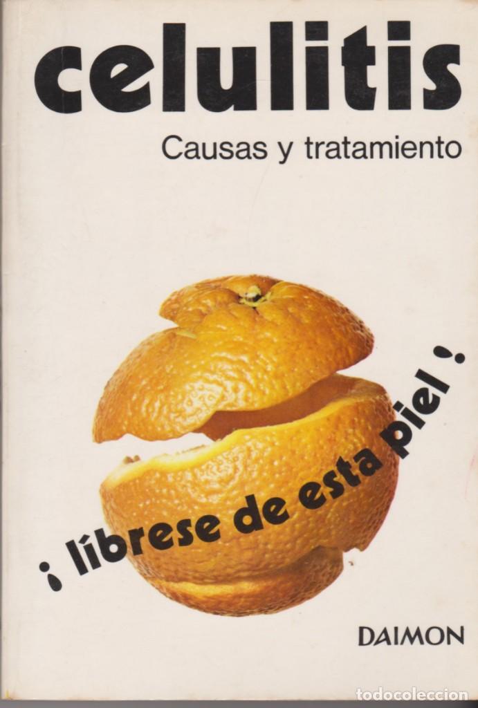 Libros: CELULITIS. CAUSAS Y TRATAMIENTO - Foto 1
