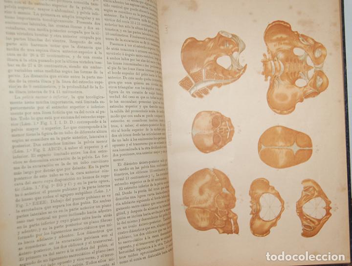 Libros: MANUAL DE OBSTETRICIA. Obra indispensable a la clase de comadronas - D.A. FORMICA-CORSI - Foto 6