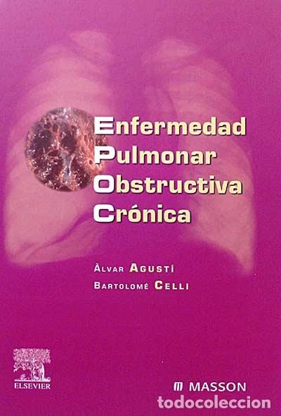 Libros: Enfermedad pulmonar obstructiva cr&oacute;nica - &Agrave;lvar Agust&iacute;. Bartolom&eacute; Celli. - Foto 1