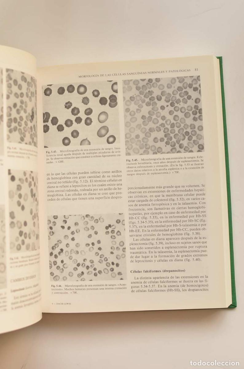 Libros: Hematolog&iacute;a pr&aacute;ctica - DACIE, J. V.&nbsp; y LEWIS, S. M. - Foto 3