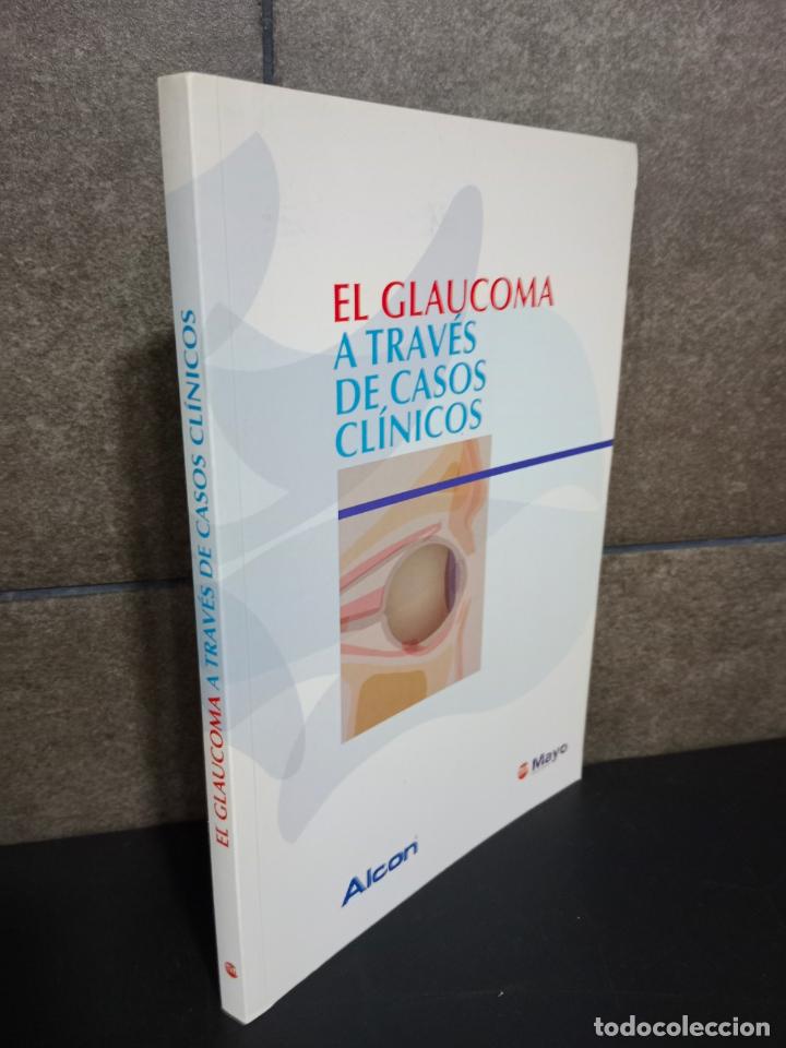 B&uuml;cher: EL GLAUCOMA A TRAVES DE CASOS CLINICOS. MARIA ISABEL CANUT JORDANA. ALICIA COLIN MALAGON. ANTONI DOU