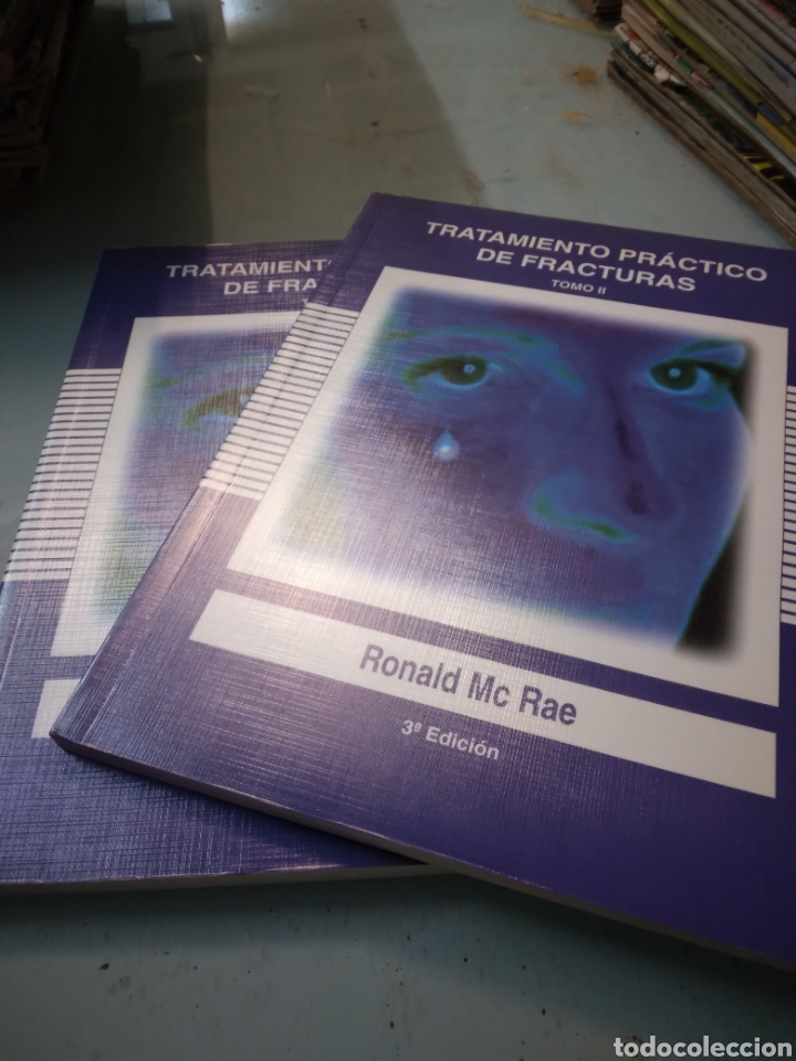 Libros: Ronald Mc Rae, Tratamiento pr&aacute;ctico de fracturas - Foto 1