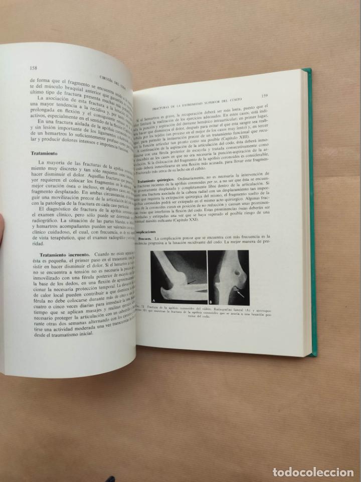 Libros: Cirug&iacute;a del Codo - &rdquo;SMITH, F.M&rdquo; - Foto 4